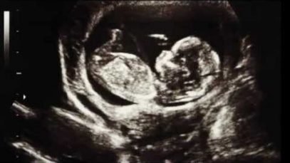 Two Wrongs Don’t Make It Right